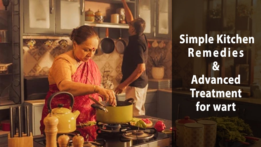 How to Remove Warts at Home: Simple Kitchen Remedies & Advanced Treatment