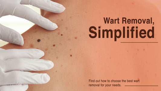 How to Choose the Right Wart Removal Cream for Your Skin