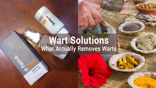 Wart Removal Cream vs. Home Remedies: What Works Best