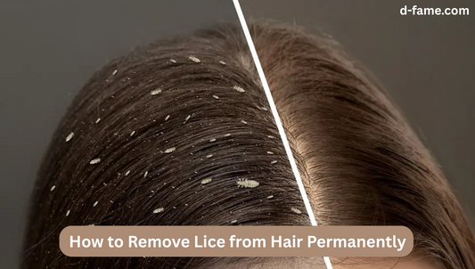 How to Remove Lice from Hair Permanently