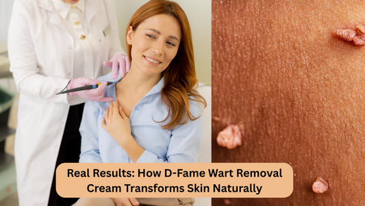 Real Results: How D-Fame Wart Removal Cream Transforms Skin Naturally