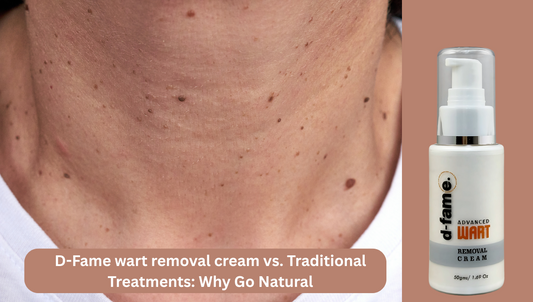 D-Fame wart removal cream vs. Traditional Treatments: Why Go Natural