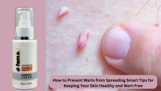 How to Prevent Warts from Spreading Smart Tips for Keeping Your Skin Healthy and Wart-Free