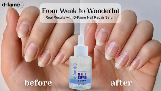 From Weak to Wonderful: Real Results with D-Fame Nail Repair Serum