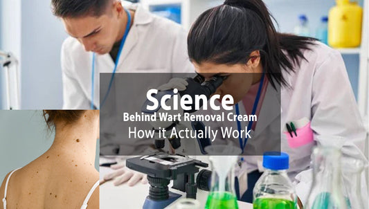 The Science Behind Wart Removal Cream: How It Works