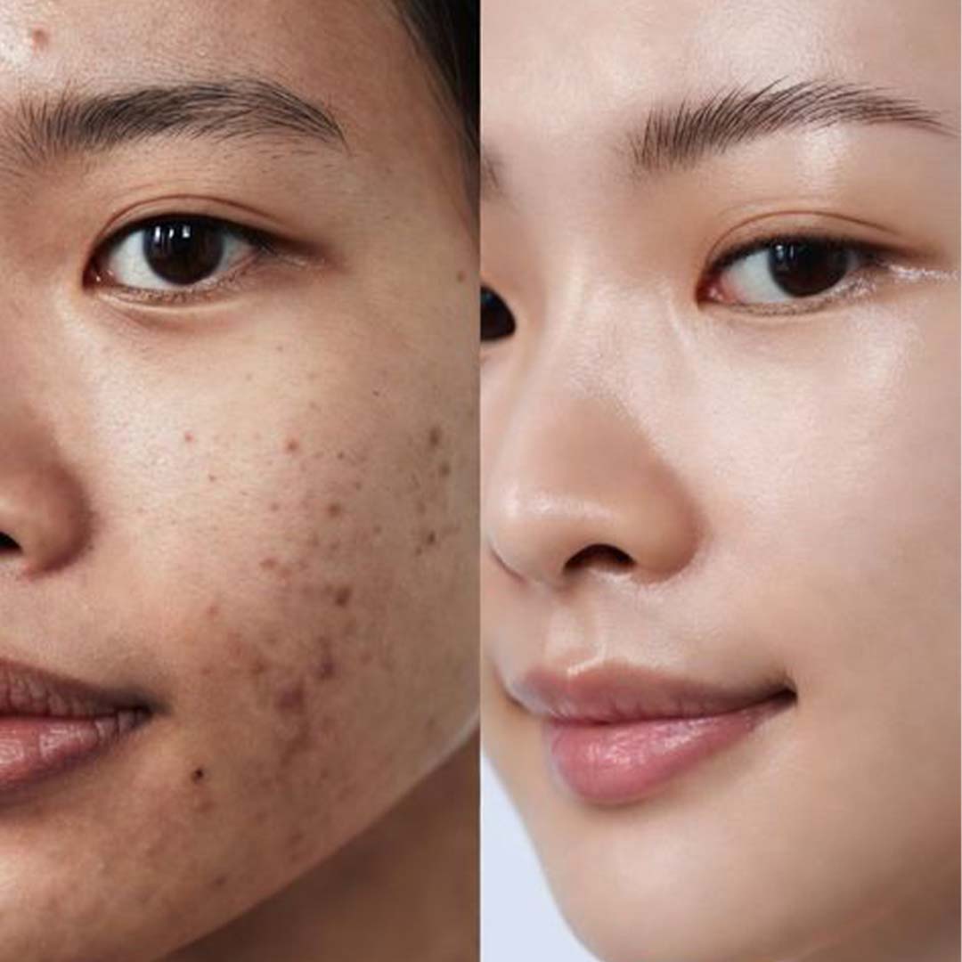 K-Glow Serum – Advanced Glass Skin Brightening Formula