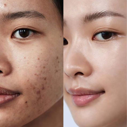 K-Glow Serum – Advanced Glass Skin Brightening Formula