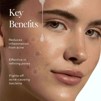 D-Fame Pimple & Anti-Acne Serum – Clear Skin, Oil Control & Spot Reduction