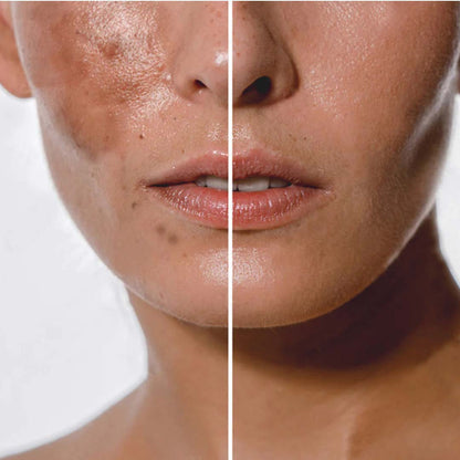 D-Fame TANOUT+ Exfoliating Serum – Anti-Pigmentation & Tan Removal Formula