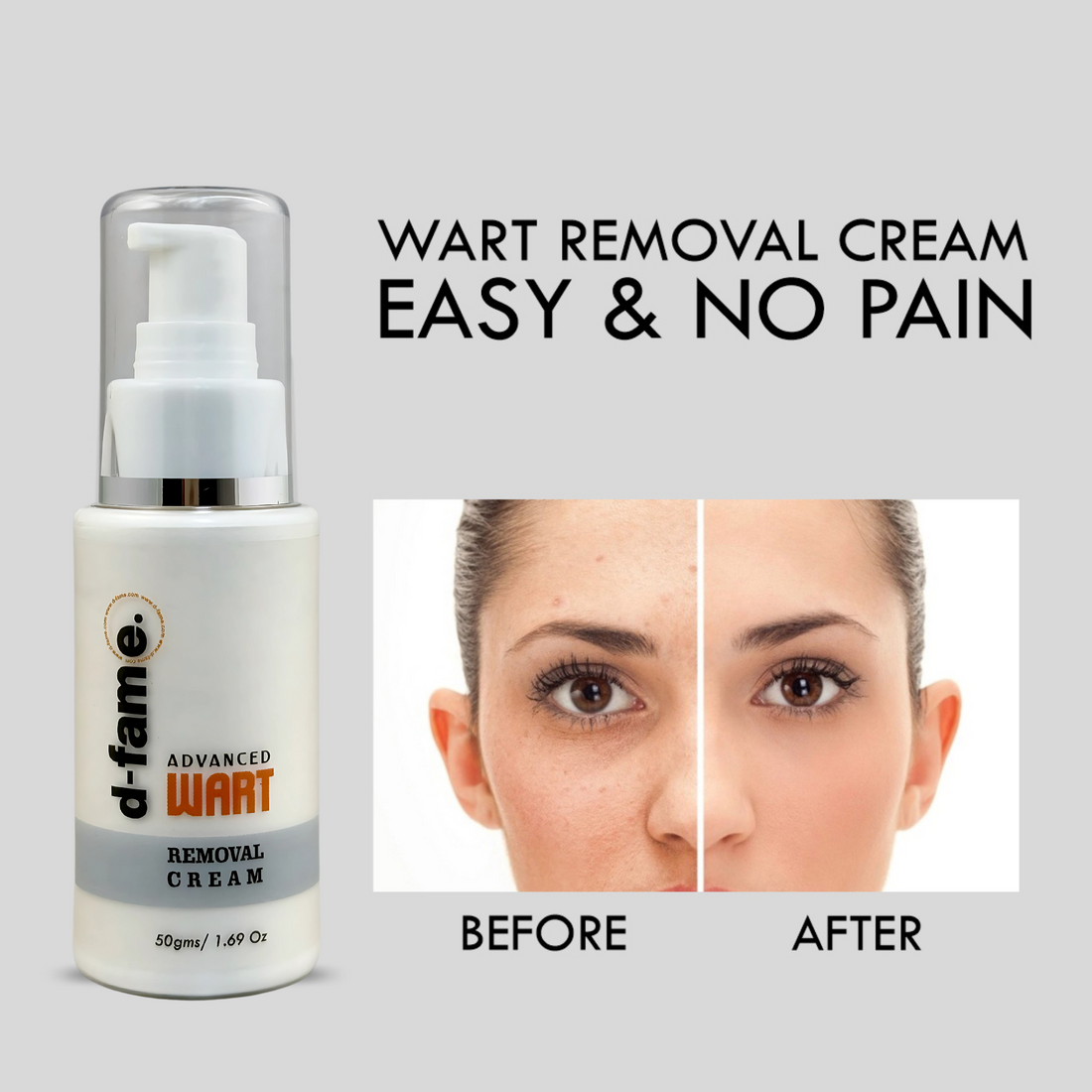 D-Fame Advanced Wart Removal Cream